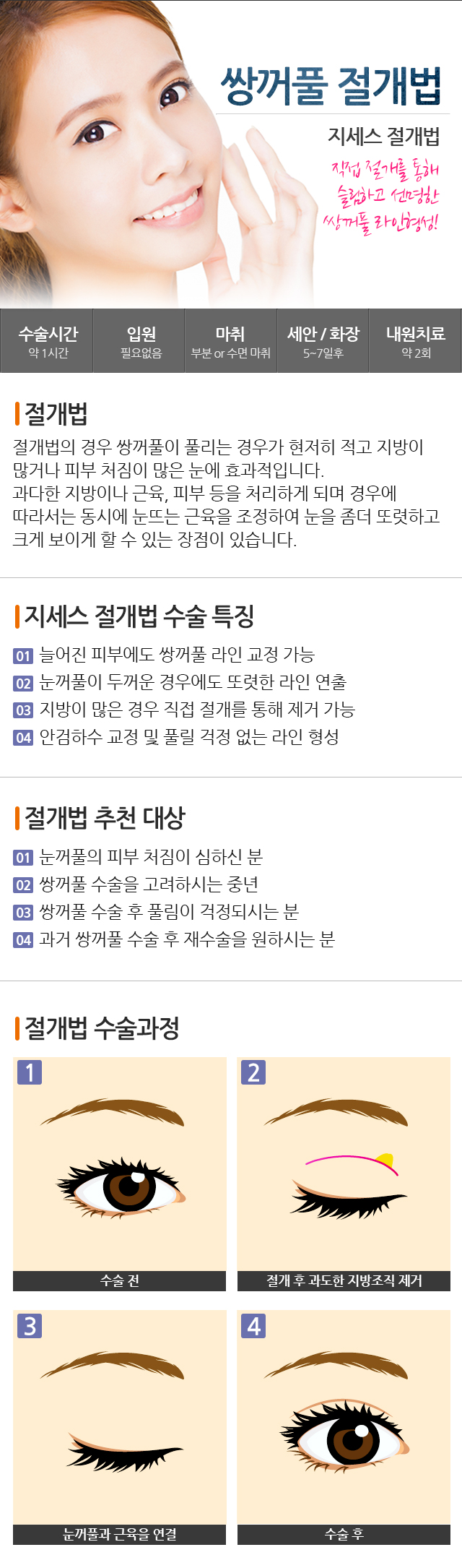 �ֲ�Ǯ ������