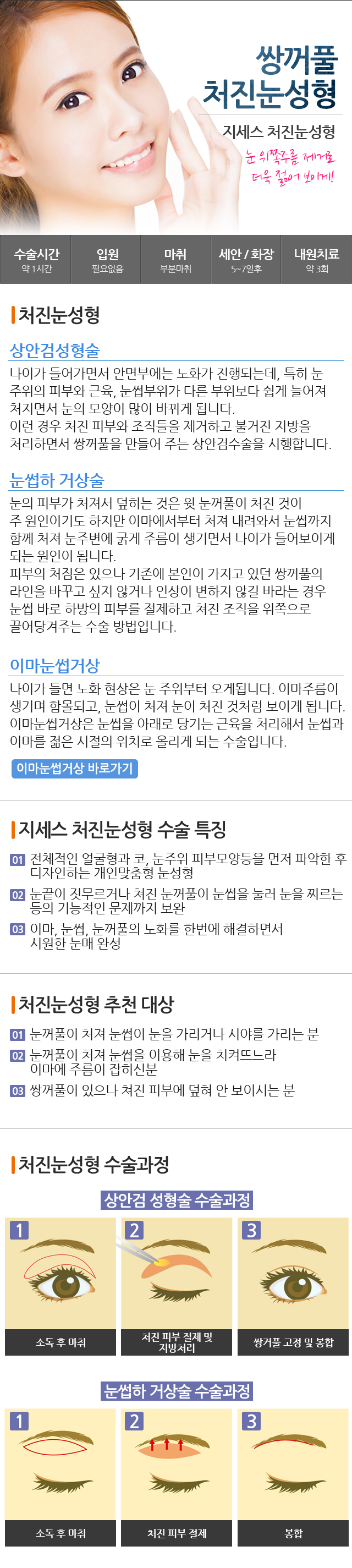 ó��������