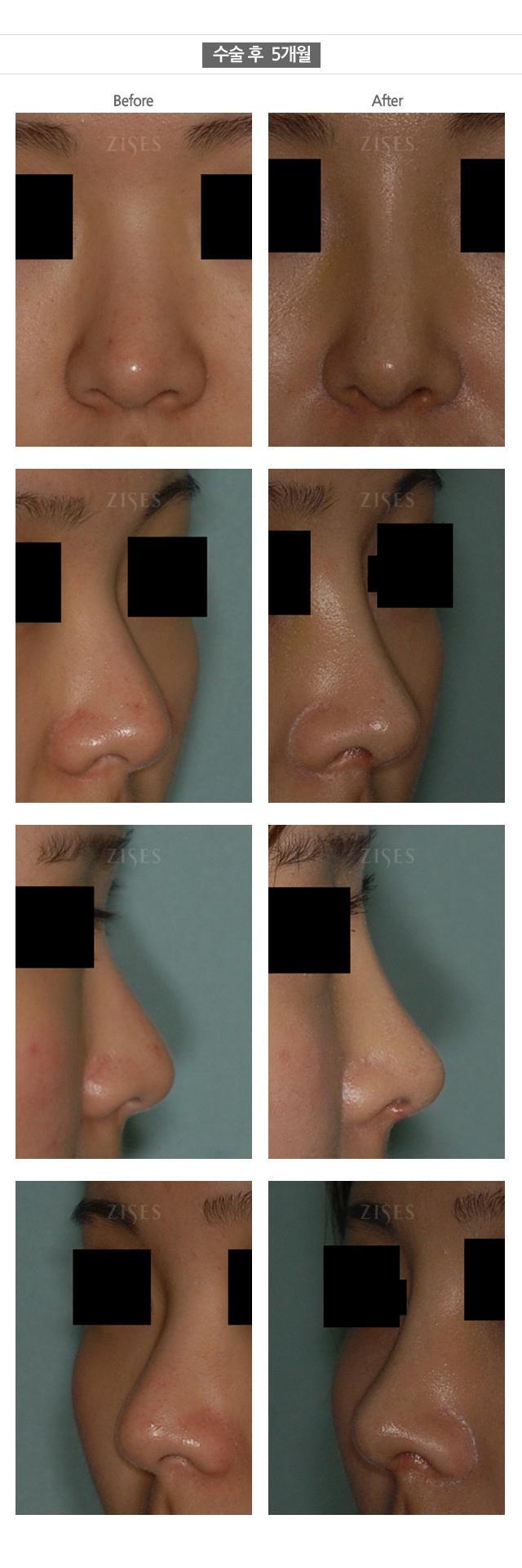 �ڼ������Ļ���