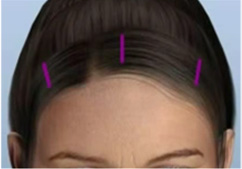 �̸�����Ż� �������