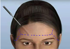 �̸�����Ż� �������