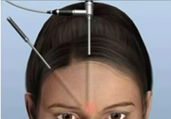 �̸�����Ż� �������