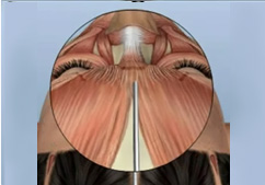 �̸�����Ż� �������