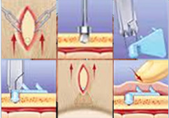 �̸�����Ż� �������