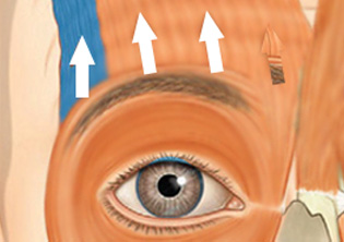 ������ ���� �÷��ִ� ����