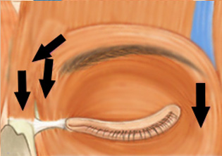 ������ �Ʒ��� ���� ����