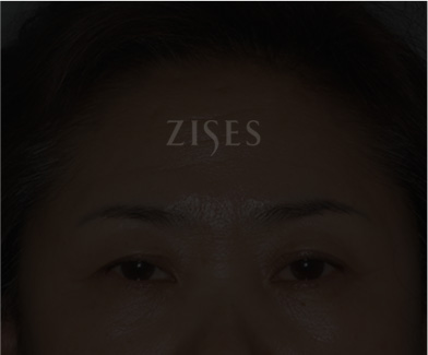 �̸�����Ż�� ���� ����