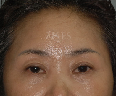 �̸�����Ż�� ���� ����