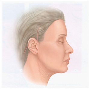 �ȸ�Ż�� ���� ����