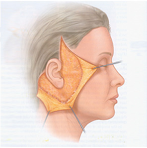 �ȸ�Ż�� ���� ����