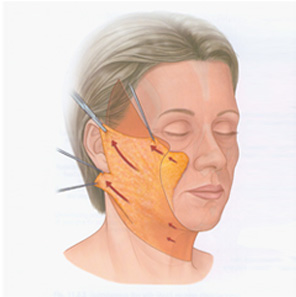 �ȸ�Ż�� ���� ����