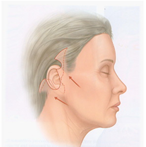 �ȸ�Ż�� ���� ����