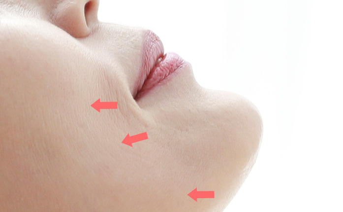 �̸����� �Ż��