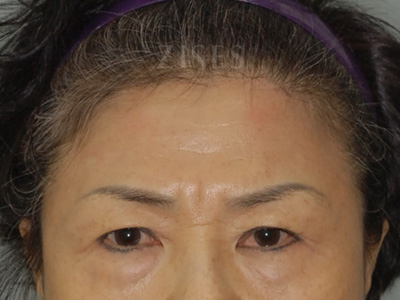 ���� ���� ����