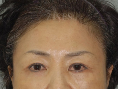 ���� ���� ����