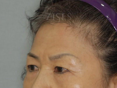 ���� ���� ����