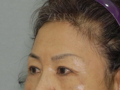 ���� ���� ����