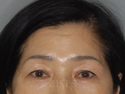 ���� ���� ����