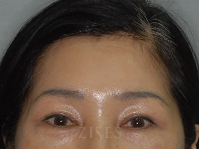 ���� ���� ����