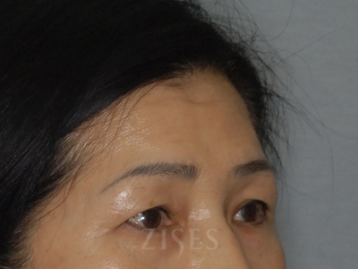 ���� ���� ����