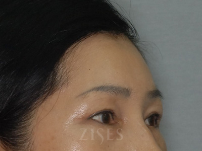 ���� ���� ����