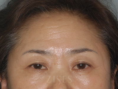 ���� ���� ����