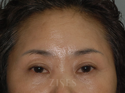 ���� ���� ����