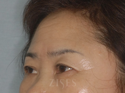 ���� ���� ����