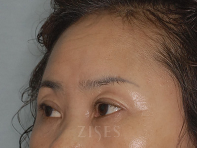 ���� ���� ����