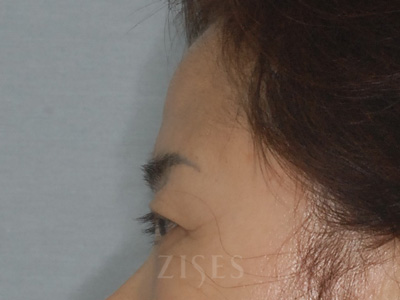 ���� ���� ����