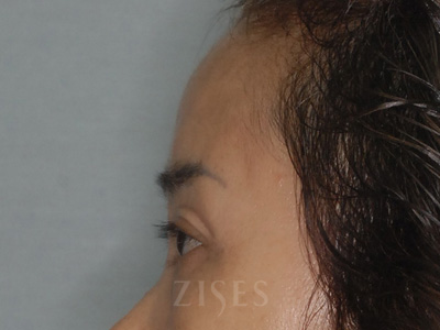 ���� ���� ����