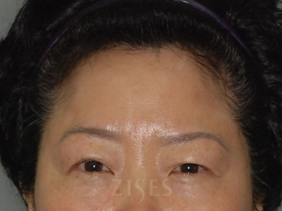 ���� ���� ����