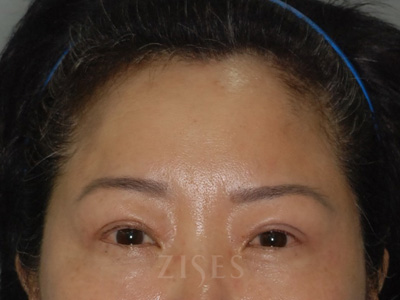 ���� ���� ����