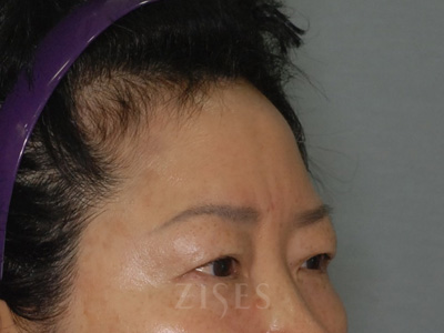 ���� ���� ����