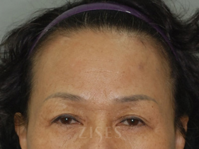 ���� ���� ����