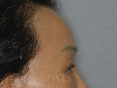 ���� ���� ����