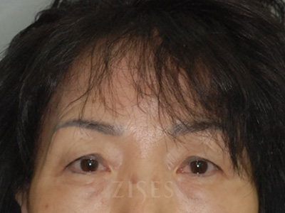 ���� ���� ����