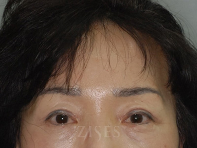 ���� ���� ����