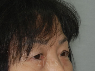 ���� ���� ����