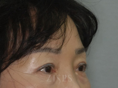 ���� ���� ����