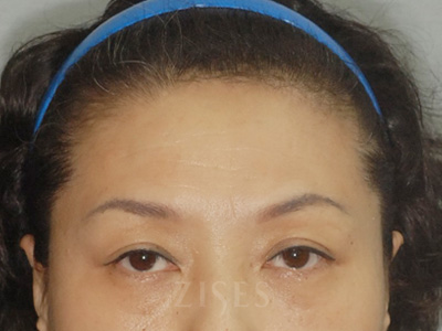 ���� ���� ����