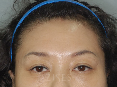 ���� ���� ����