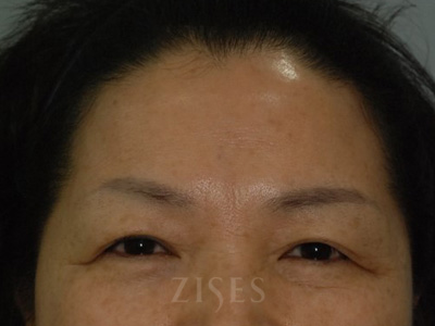 ���� ���� ����