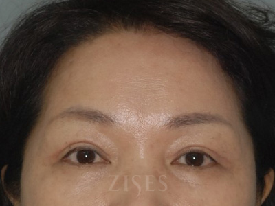 ���� ���� ����