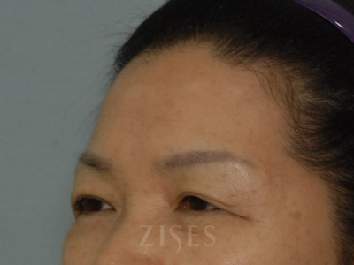 ���� ���� ����