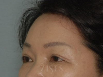 ���� ���� ����