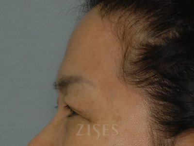 ���� ���� ����