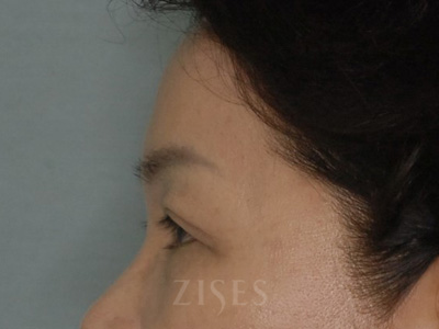 ���� ���� ����