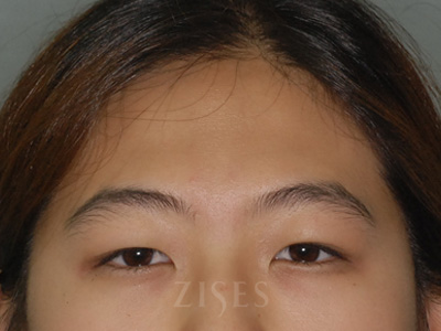 ���� ���� ����