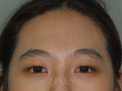 ���� ���� ����